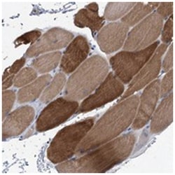 MYOZ3, Rabbit, Polyclonal Antibody, Abnova 100 &mu;L | Buy Online | Abnova Corporation | Fisher Scientific