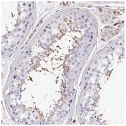 ODF3, Rabbit, Polyclonal Antibody, Abnova 100&mu;L; Unlabeled:Antibodies,