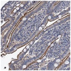IFITM5, Rabbit, Polyclonal Antibody, Abnova 100 &mu;L | Buy Online | Abnova Corporation | Fisher Scientific