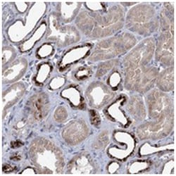 C11orf86, Rabbit, Polyclonal Antibody, Abnova 100 &mu;L | Buy Online | Abnova Corporation | Fisher Scientific