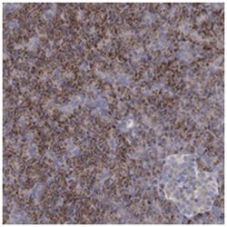 DCUN1D2, Rabbit, Polyclonal Antibody, Abnova 100 &mu;L | Buy Online | Abnova Corporation | Fisher Scientific