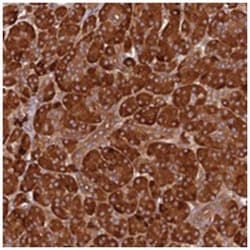 CCDC89, Rabbit, Polyclonal Antibody, Abnova 100 &mu;L | Buy Online | Abnova Corporation | Fisher Scientific