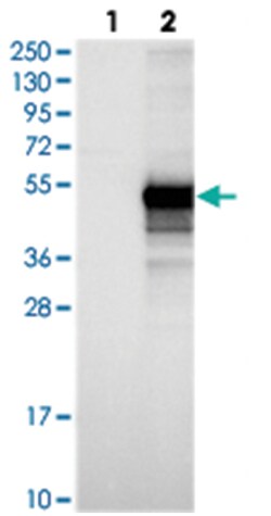 CCDC89, Rabbit, Polyclonal Antibody, Abnova 100 &mu;L | Buy Online | Abnova Corporation | Fisher Scientific