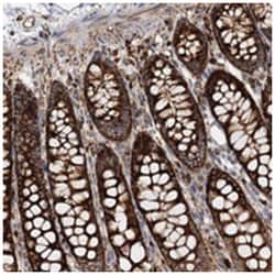 WDR73, Rabbit, Polyclonal Antibody, Abnova 100&mu;L; Unlabeled:Antibodies,