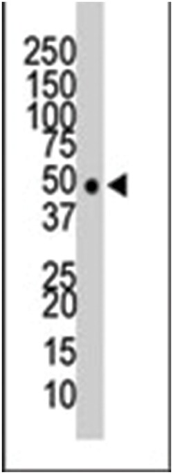 HDAC11 Rabbit anti-Human, Mouse, Polyclonal Antibody, Abnova 400 &mu;L | Buy Online | Abnova Corporation | Fisher Scientific