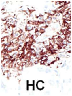 HDAC11 Rabbit anti-Human, Mouse, Polyclonal Antibody, Abnova 400 &mu;L | Buy Online | Abnova Corporation | Fisher Scientific