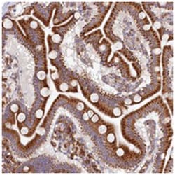 CHID1, Rabbit, Polyclonal Antibody, Abnova 100&mu;L; Unlabeled:Antibodies,