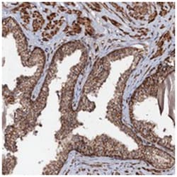 CEP76 Rabbit anti-Human, Polyclonal Antibody, Abnova 100 &mu;L | Buy Online | Abnova Corporation | Fisher Scientific
