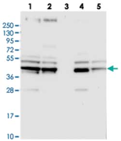 SUCLA2, Rabbit, Polyclonal Antibody, Abnova 100 &mu;L | Buy Online | Abnova Corporation | Fisher Scientific