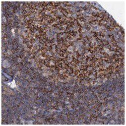 ANKRD13A, Rabbit, Polyclonal Antibody, Abnova 100&mu;L; Unlabeled:Antibodies,