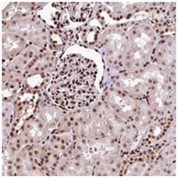 PDS5B Rabbit anti-Human, Polyclonal Antibody, Abnova 100 &mu;L | Buy Online | Abnova Corporation | Fisher Scientific