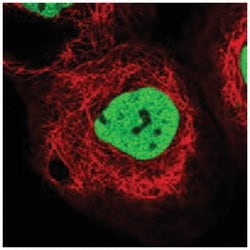 PDS5B Rabbit anti-Human, Polyclonal Antibody, Abnova 100 &mu;L | Buy Online | Abnova Corporation | Fisher Scientific