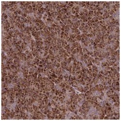 TNPO3 Rabbit anti-Human, Polyclonal Antibody, Abnova 100&mu;L; Unlabeled:Antibodies,