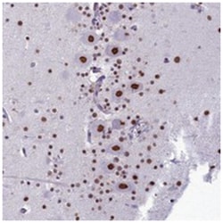 PARPBP, Rabbit, Polyclonal Antibody, Abnova 100 &mu;L | Buy Online | Abnova Corporation | Fisher Scientific