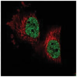 PARPBP, Rabbit, Polyclonal Antibody, Abnova 100 &mu;L | Buy Online | Abnova Corporation | Fisher Scientific