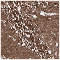CAPRIN2, Rabbit, Polyclonal Antibody, Abnova 100 &mu;L | Buy Online | Abnova Corporation | Fisher Scientific