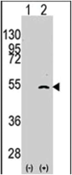 ELP3 Rabbit anti-Human, Polyclonal Antibody, Abnova 400 &mu;L | Buy Online | Abnova Corporation | Fisher Scientific
