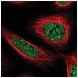 RUFY2, Rabbit, Polyclonal Antibody, Abnova 100&mu;L; Unlabeled:Antibodies,