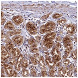 BET1L, Rabbit, Polyclonal Antibody, Abnova 100&mu;L; Unlabeled:Antibodies,