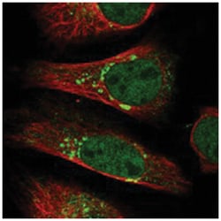 BET1L, Rabbit, Polyclonal Antibody, Abnova 100&mu;L; Unlabeled:Antibodies,