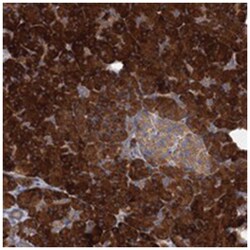 ALKBH7, Rabbit, Polyclonal Antibody, Abnova 100&mu;L; Unlabeled:Antibodies,