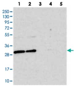 BCDIN3D, Rabbit, Polyclonal Antibody, Abnova 100 &mu;L | Buy Online | Abnova Corporation | Fisher Scientific