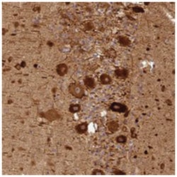 BCDIN3D, Rabbit, Polyclonal Antibody, Abnova 100 &mu;L | Buy Online | Abnova Corporation | Fisher Scientific