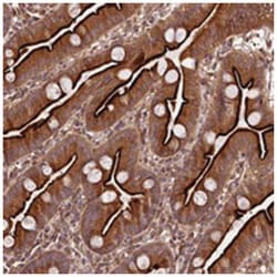 TREH, Rabbit, Polyclonal Antibody, Abnova 100 &mu;L | Buy Online | Abnova Corporation | Fisher Scientific