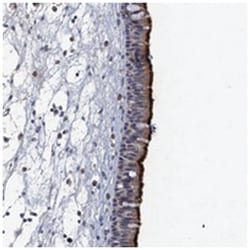 ANKRD42, Rabbit, Polyclonal Antibody, Abnova 100 &mu;L | Buy Online | Abnova Corporation | Fisher Scientific