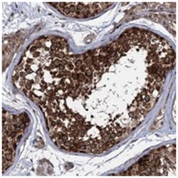 FLJ32810, Rabbit, Polyclonal Antibody, Abnova 100 &mu;L | Buy Online | Abnova Corporation | Fisher Scientific