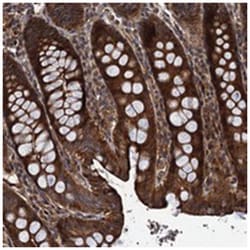 TMEM67, Rabbit, Polyclonal Antibody, Abnova 100 &mu;L | Buy Online | Abnova Corporation | Fisher Scientific