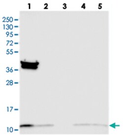 TIMM10, Rabbit, Polyclonal Antibody, Abnova 100 &mu;L | Buy Online | Abnova Corporation | Fisher Scientific