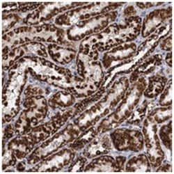 TIMM10, Rabbit, Polyclonal Antibody, Abnova 100 &mu;L | Buy Online | Abnova Corporation | Fisher Scientific