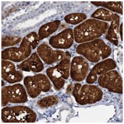 C15orf39, Rabbit, Polyclonal Antibody, Abnova 100 &mu;L | Buy Online | Abnova Corporation | Fisher Scientific