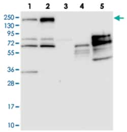 PDS5B Rabbit anti-Human, Mouse, Rat, Polyclonal Antibody, Abnova 100 &mu;L | Buy Online | Abnova Corporation | Fisher Scientific