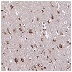 PDS5B Rabbit anti-Human, Mouse, Rat, Polyclonal Antibody, Abnova 100 &mu;L | Buy Online | Abnova Corporation | Fisher Scientific