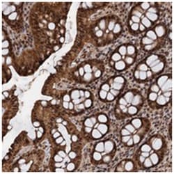 FAM216B, Rabbit, Polyclonal Antibody, Abnova 100&mu;L; Unlabeled:Antibodies,