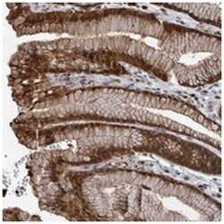 C11orf84, Rabbit, Polyclonal Antibody, Abnova 100 &mu;L | Buy Online | Abnova Corporation | Fisher Scientific