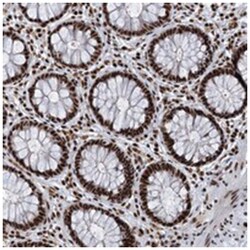 RBM26 Rabbit anti-Human, Polyclonal Antibody, Abnova 100 &mu;L | Buy Online | Abnova Corporation | Fisher Scientific