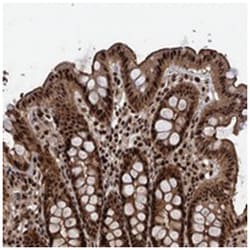 ANKRD49, Rabbit, Polyclonal Antibody, Abnova 100 &mu;L | Buy Online | Abnova Corporation | Fisher Scientific