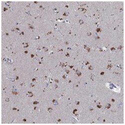 TXNDC14, Rabbit, Polyclonal Antibody, Abnova 100&mu;L; Unlabeled:Antibodies,