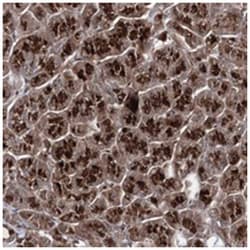 MICALCL, Rabbit, Polyclonal Antibody, Abnova 100 &mu;L | Buy Online | Abnova Corporation | Fisher Scientific