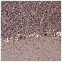 ANKRD12, Rabbit, Polyclonal Antibody, Abnova 100&mu;L; Unlabeled:Antibodies,
