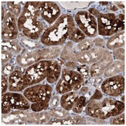 C20orf196, Rabbit, Polyclonal Antibody, Abnova 100 &mu;L | Buy Online | Abnova Corporation | Fisher Scientific