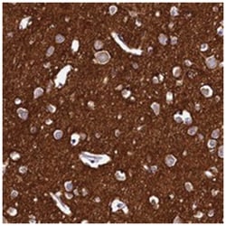 DTD1, Rabbit, Polyclonal Antibody, Abnova 100 &mu;L | Buy Online | Abnova Corporation | Fisher Scientific