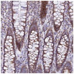 TMEM206, Rabbit, Polyclonal Antibody, Abnova 100&mu;L; Unlabeled:Antibodies,