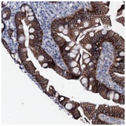 SLC4A7, Rabbit, Polyclonal Antibody, Abnova 100&mu;L; Unlabeled:Antibodies,