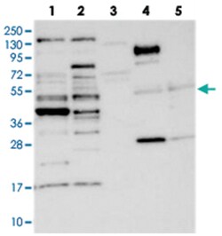 CCDC34, Rabbit, Polyclonal Antibody, Abnova 100 &mu;L | Buy Online | Abnova Corporation | Fisher Scientific