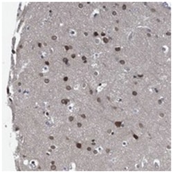 CCDC34, Rabbit, Polyclonal Antibody, Abnova 100 &mu;L | Buy Online | Abnova Corporation | Fisher Scientific