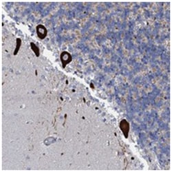 OLAH Rabbit anti-Human, Polyclonal Antibody, Abnova 100 &mu;L | Buy Online | Abnova Corporation | Fisher Scientific